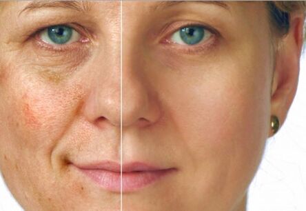 The results of rejuvenation
