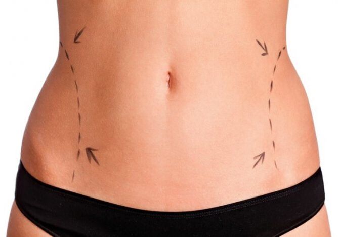 Problem areas on both sides