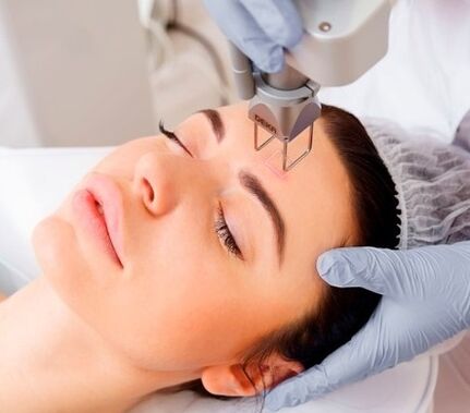 The nature of the micro laser facial rejuvenation procedure