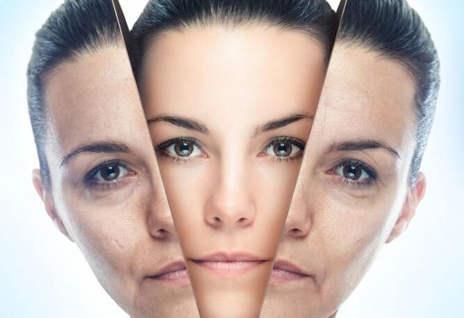 The process of ridding the face of age-related changes